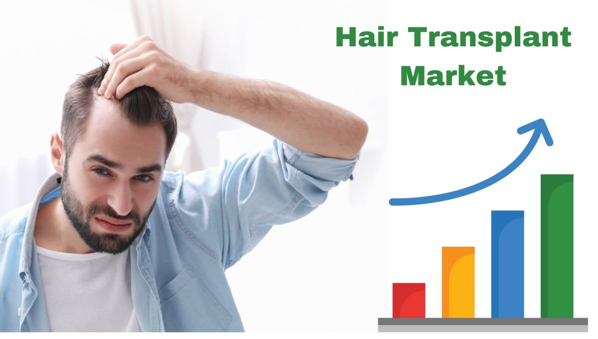 Hair Transplant India: Worth Your Investment?